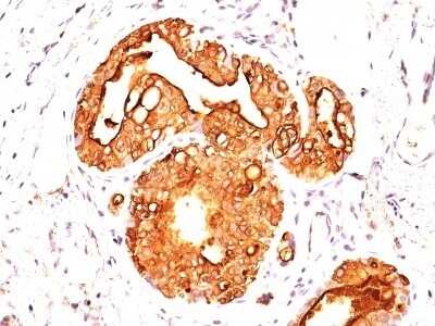 Immunohistochemistry-Paraffin: MUC1 Antibody (MUC1/845) [NBP2-44655]