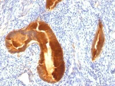 Immunohistochemistry-Paraffin: MUC1 Antibody (MUC1/955) - Azide and BSA Free [NBP2-47884]