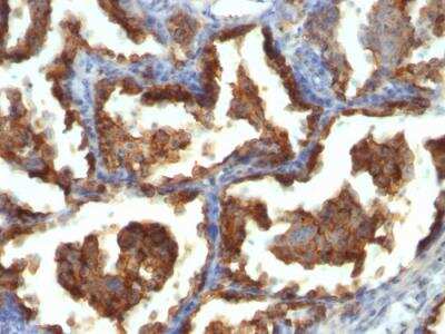 Immunohistochemistry-Paraffin: MUC1 Antibody (MUC1/955) - IHC-Prediluted [NBP2-48360]