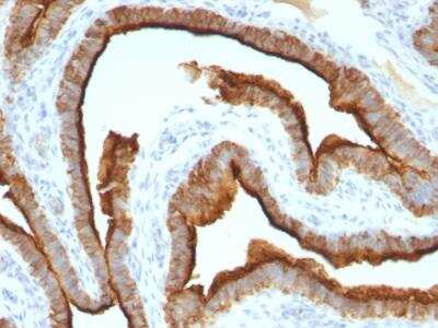 Immunohistochemistry-Paraffin: MUC1 Antibody (MUC1/967) - IHC-Prediluted [NBP2-48361]