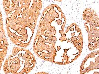 Immunohistochemistry-Paraffin: MUC1 Antibody (MUC1/967) - IHC-Prediluted [NBP2-48361]