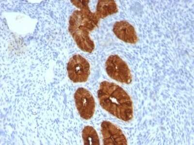 Immunohistochemistry-Paraffin: MUC1 Antibody (MUC1/967) [NBP2-44659]