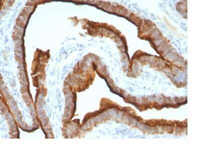 Immunohistochemistry-Paraffin: MUC1 Antibody (MUC1/967) [NBP2-44659]