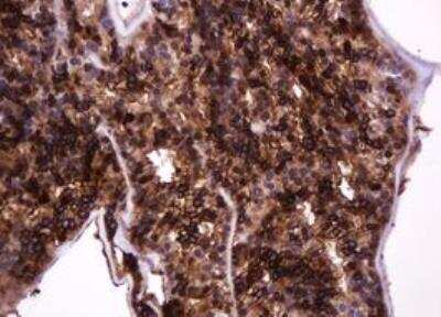 Immunohistochemistry-Paraffin: MUC1 Antibody (OTI2E3) - Azide and BSA Free [NBP2-72826]