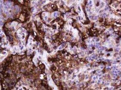 Immunohistochemistry-Paraffin: MUC1 Antibody (OTI2E3) - Azide and BSA Free [NBP2-72826]