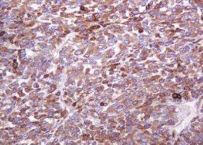 Immunohistochemistry-Paraffin: MUC1 Antibody (OTI2E3) - Azide and BSA Free [NBP2-72826]