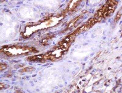 Immunohistochemistry-Paraffin: MUC1 Antibody (OTI2E3) - Azide and BSA Free [NBP2-72826]