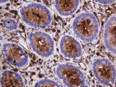 Immunohistochemistry-Paraffin: MUC1 Antibody (OTI2E3) - Azide and BSA Free [NBP2-72826]