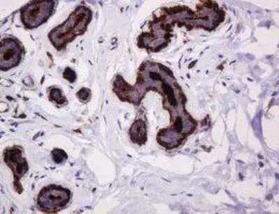 Immunohistochemistry-Paraffin: MUC1 Antibody (OTI2E3) - Azide and BSA Free [NBP2-72826]