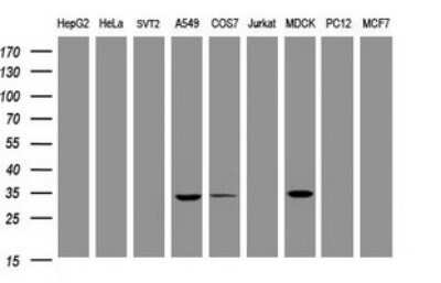 Western Blot: MUC1 Antibody (OTI2E3)Azide and BSA Free [NBP2-72826]