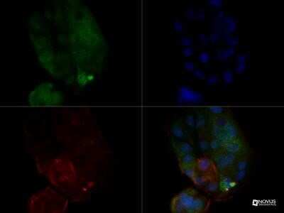 Immunocytochemistry/ Immunofluorescence: MUC1 Antibody (SM3) - Azide and BSA Free [NBP2-80859]