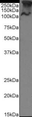 Western Blot: MUC1 Antibody (SM3)ChimericAzide and BSA Free [NBP2-62561]
