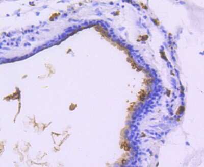 Immunohistochemistry-Paraffin: MUC1 Antibody (SN06-80) [NBP2-67650]