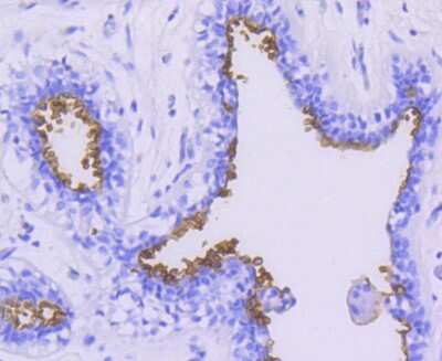 Immunohistochemistry-Paraffin: MUC1 Antibody (SN06-80) [NBP2-67650]