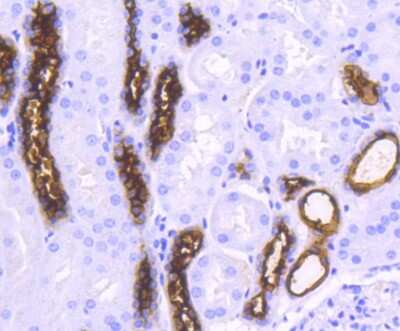 Immunohistochemistry-Paraffin: MUC1 Antibody (SN06-80) [NBP2-67650]