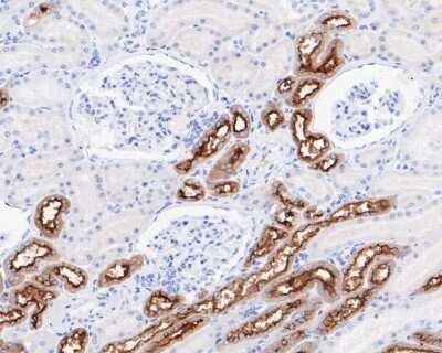 Immunohistochemistry-Paraffin: MUC1 Antibody (SN06-80) [NBP2-67650]