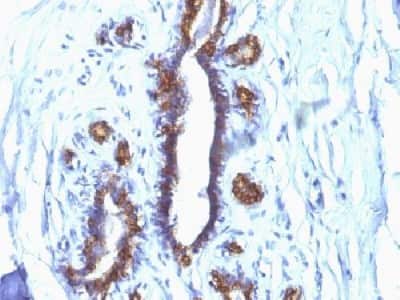 Immunohistochemistry-Paraffin: MUC1 Antibody (SPM132) [NBP2-32877]