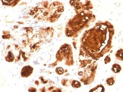 Immunohistochemistry-Paraffin: MUC1 Antibody (rMUC1/960) [NBP2-53286]