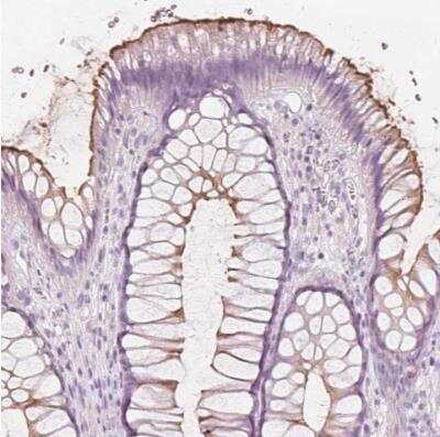 Immunohistochemistry-Paraffin: MUC12 Antibody [NBP1-82607]