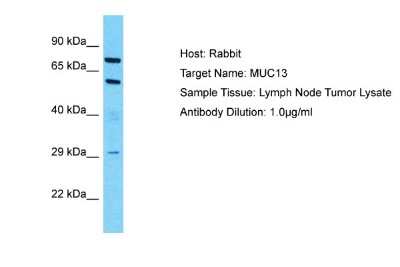 Western Blot: MUC13 Antibody [NBP2-85336]