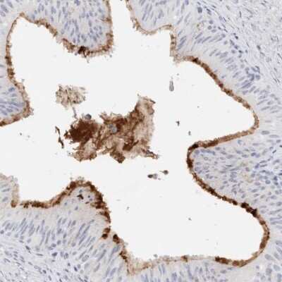 Immunohistochemistry-Paraffin: MUC15 Antibody [NBP1-86406]