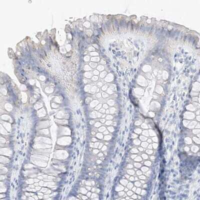 Immunohistochemistry-Paraffin: MUC17 Antibody [NBP1-91013]