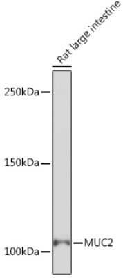 Western Blot: MUC2 Antibody (4L5Y8) [NBP3-16481]