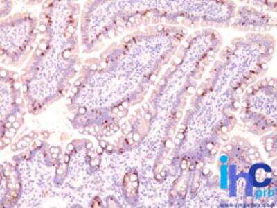 Immunohistochemistry-Paraffin: MUC2 Antibody (CCP58) [NBP2-25221]