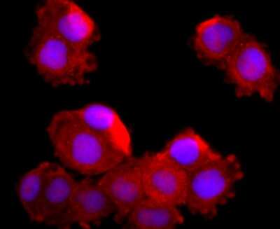 Immunocytochemistry/ Immunofluorescence: MUC2 Antibody (JA10-92) [NBP2-66961]