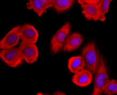 Immunocytochemistry/ Immunofluorescence: MUC2 Antibody (JA10-92) [NBP2-66961]