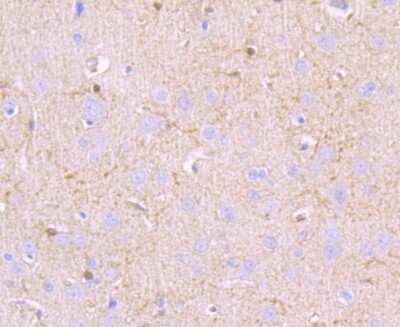 Immunohistochemistry-Paraffin: MUC2 Antibody (JA10-92) [NBP2-66961]