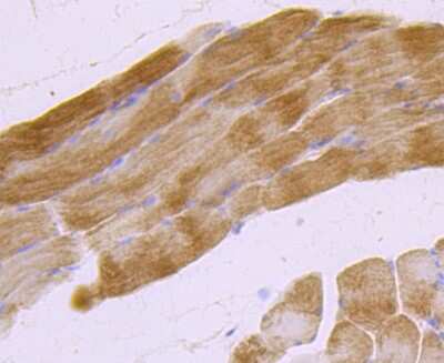 Immunohistochemistry-Paraffin: MUC2 Antibody (JA10-92) [NBP2-66961]