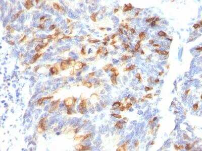 Immunohistochemistry-Paraffin: MUC2 Antibody (MLP/842) - IHC-Prediluted [NBP2-48391]