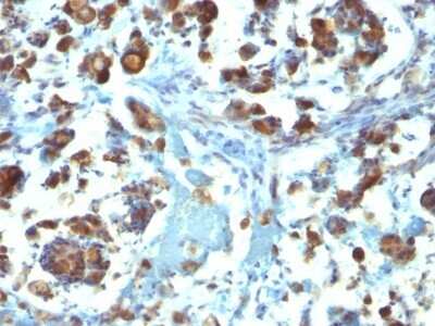 Immunohistochemistry-Paraffin: MUC3 Antibody (M3.1) [NBP2-44432]