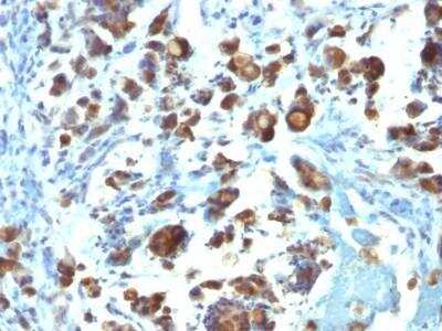 Immunohistochemistry-Paraffin: MUC3 Antibody (MUC3/1154) - Azide and BSA Free [NBP2-47687]