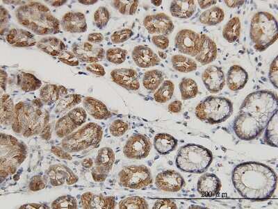 Immunohistochemistry-Paraffin: MUC4 Antibody (5B12) [H00004585-M07]