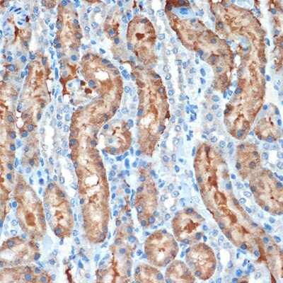 Immunohistochemistry-Paraffin: MUC4 Antibody (5J3R7) [NBP3-16186]