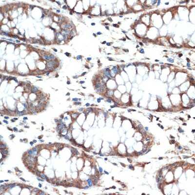 Immunohistochemistry-Paraffin: MUC4 Antibody (5J3R7) [NBP3-16186]