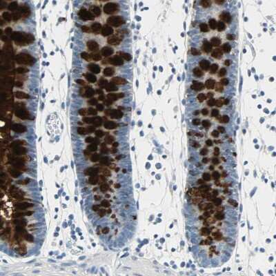 Immunohistochemistry-Paraffin: MUC4 Antibody [NBP1-86505]