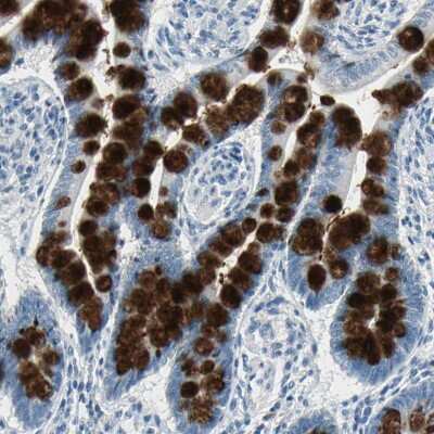 Immunohistochemistry-Paraffin: MUC4 Antibody [NBP1-86505]