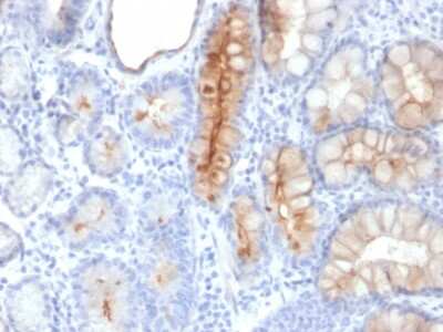 Immunohistochemistry-Paraffin: MUC4 Antibody (MUC4/3084) [NBP2-79731]