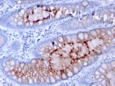 Immunohistochemistry-Paraffin: MUC4 Antibody (MUC4/3084) [NBP2-79731]