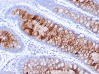 Immunohistochemistry-Paraffin: MUC4 Antibody (MUC4/3105) - Azide and BSA Free [NBP2-79867]