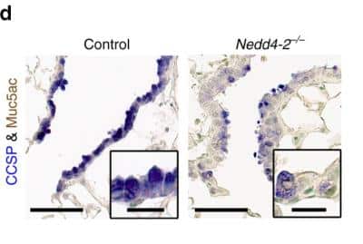 Immunohistochemistry: MUC5AC Antibody (45M1) [NBP2-15196]