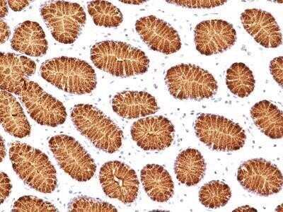 Immunohistochemistry-Paraffin: MUC5AC Antibody (45M1) [NBP2-15196]