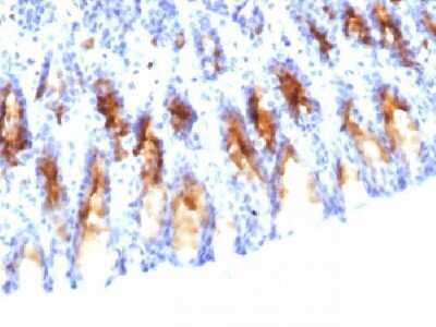 Immunohistochemistry-Paraffin: MUC5AC Antibody (45M1) [NBP2-15196]