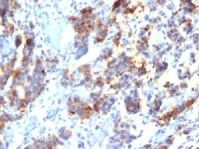 Immunohistochemistry-Paraffin: MUC5AC Antibody (45M1) [NBP2-15196]