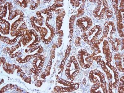 Immunohistochemistry-Paraffin: MUC5AC Antibody (CLH2) [NBP2-44455]