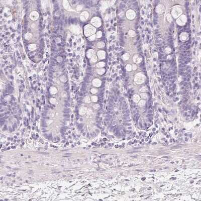 Immunohistochemistry-Paraffin: MUC5AC Antibody [NBP2-31986]
