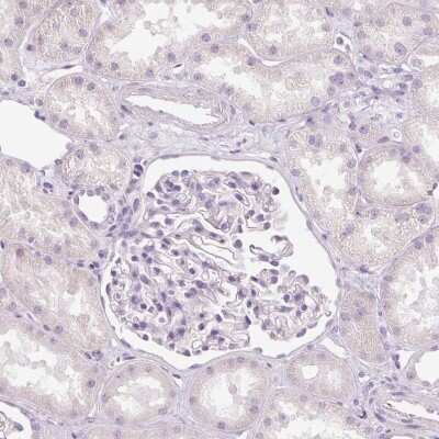Immunohistochemistry-Paraffin: MUC5AC Antibody [NBP2-31986]